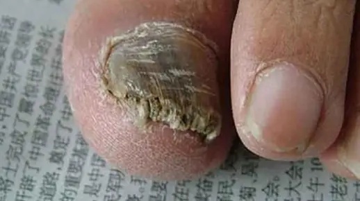 硬甲皮厚皮做什么赚钱 硬甲皮和厚皮