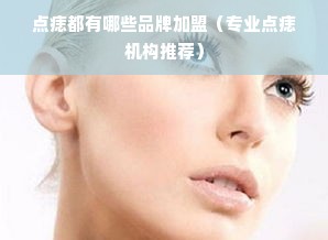 点痣都有哪些品牌加盟（专业点痣机构推荐）