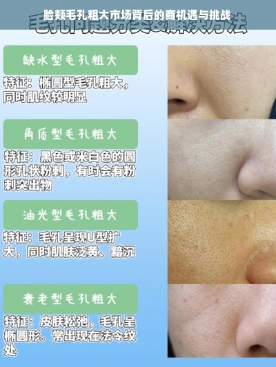 脸颊毛孔粗大市场背后的商机遇与挑战